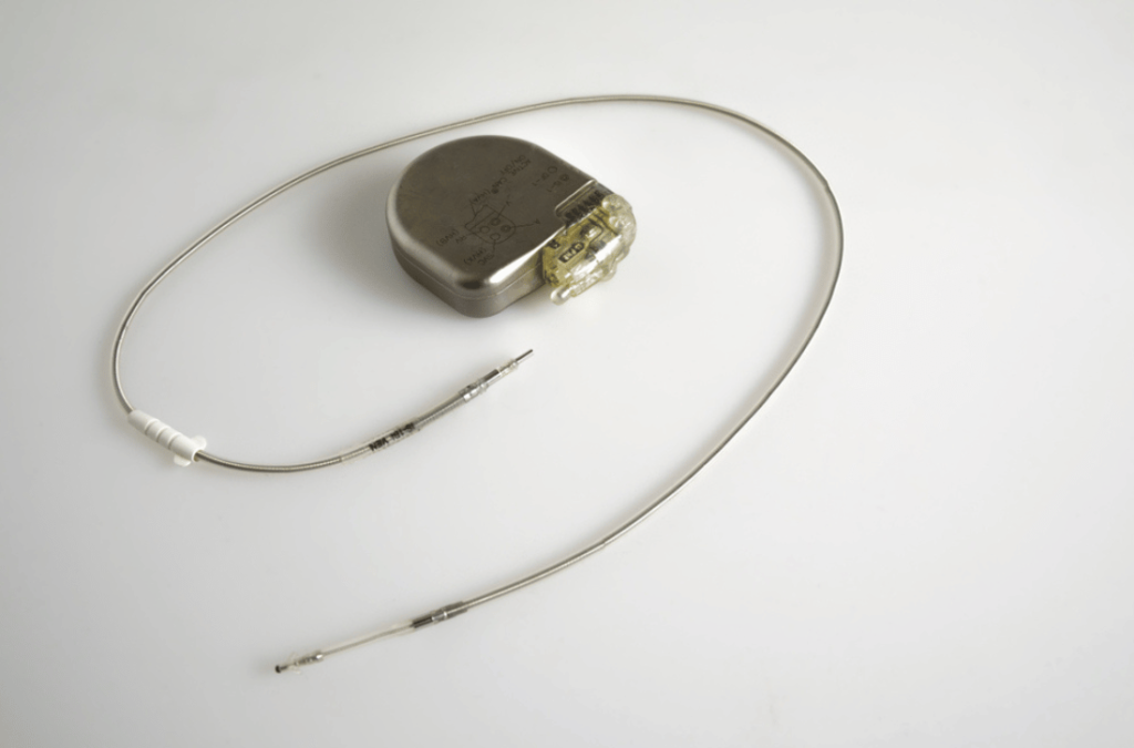 Implantable Cardioverter Defibrillator Implantation - Dr Ankeet Dhedhia